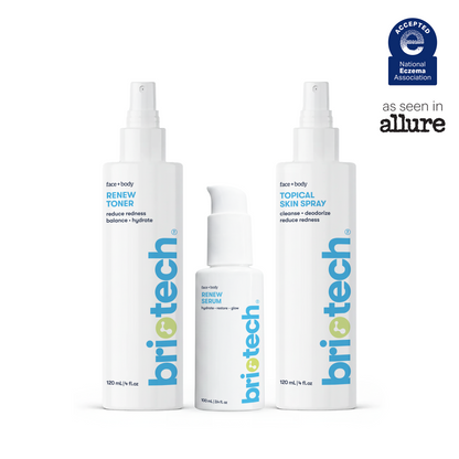 Skincare Essentials Set featuring a Renew Toner, a Renew Serum, and a soothing skin spray, complete with the National Eczema Association seal and an as seen in Allure logo.