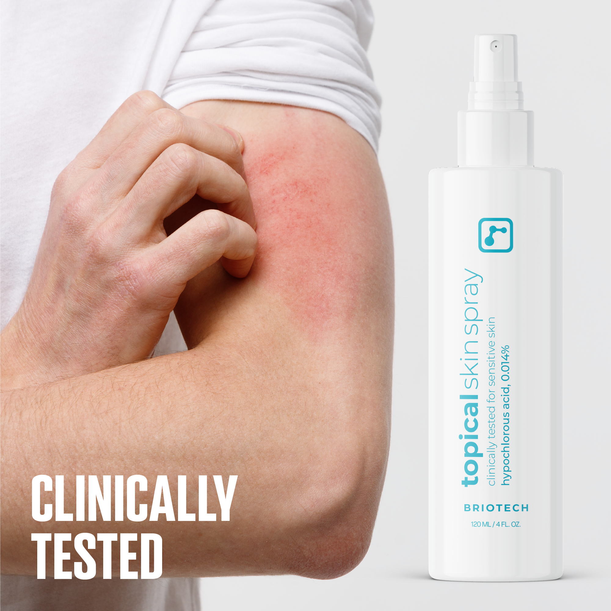 Topical Skin Spray