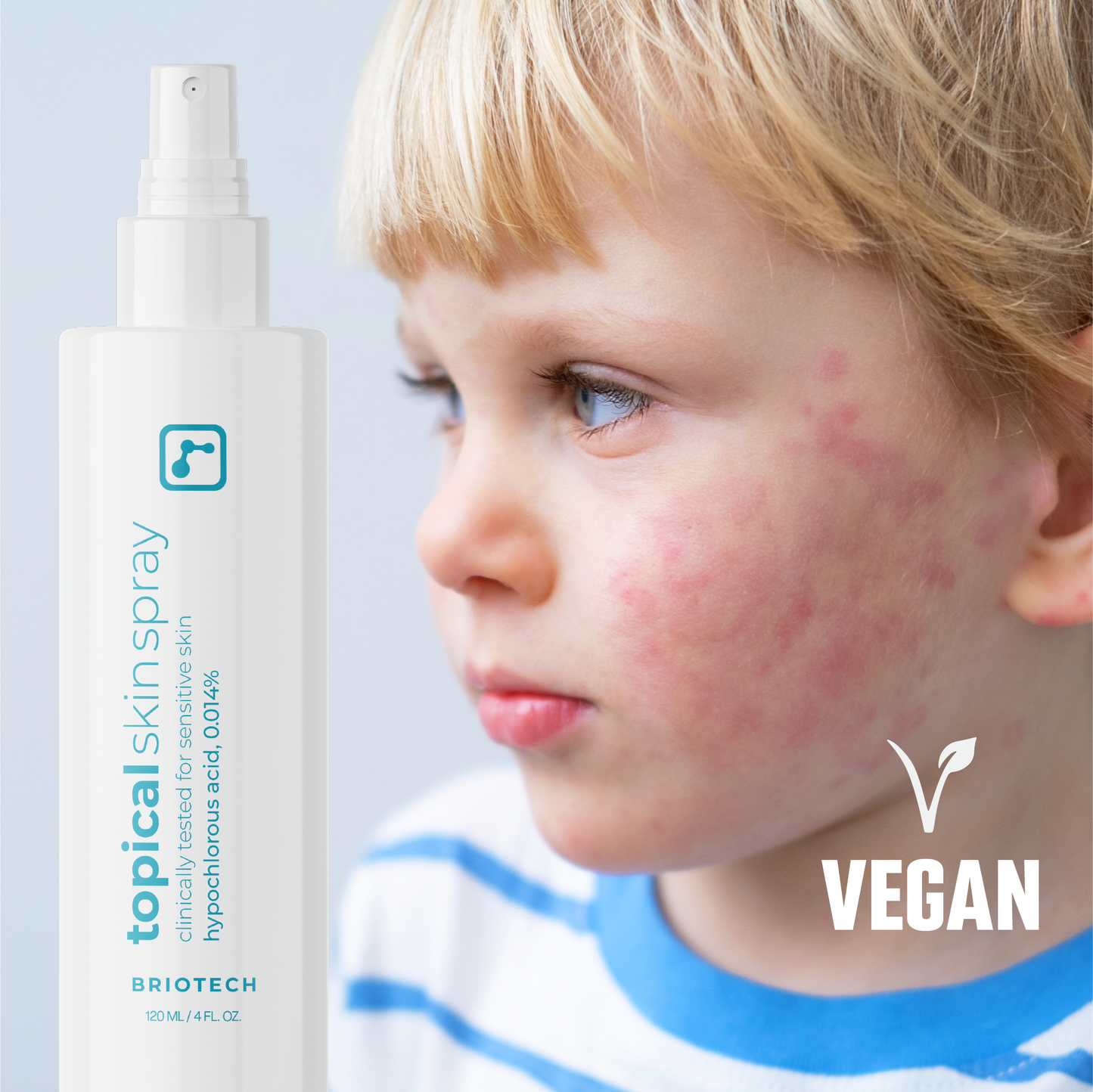 Topical Skin Spray (Wholesale)