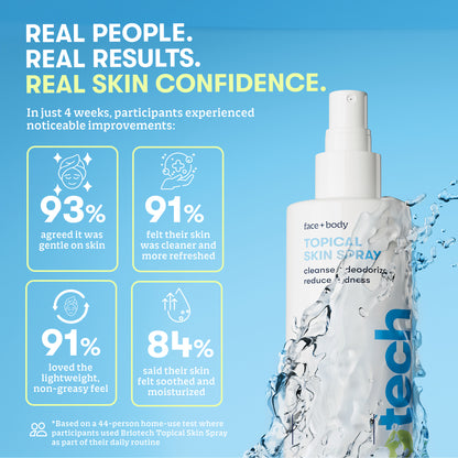 A bottle of Topical Skin Spray is shown with water splashing around it. Text highlights survey results: 93% found it gentle, 91% noticed cleaner skin, 91% loved its feel, and 84% said their skin felt soothed and moisturized after use. This refreshing spray is specially formulated to calm irritation and visibly reduce blemishes, leaving your complexion feeling revitalized.